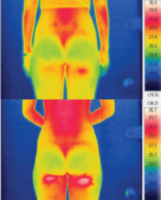 Correct Anterior Pelvic Tilt