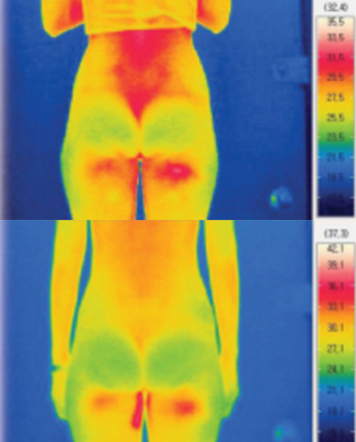 Correct Anterior Pelvic Tilt